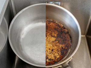 رفع سوختگی